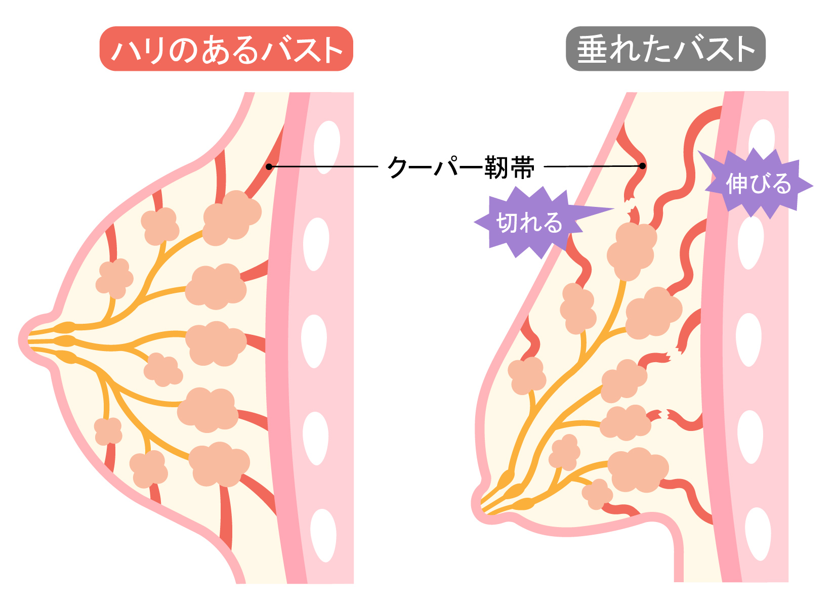 産後の垂れた胸の改善方法